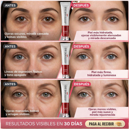 EYE SKIN CONTOUR ROLL-ON