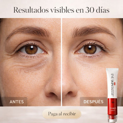 EYE SKIN CONTOUR ROLL-ON