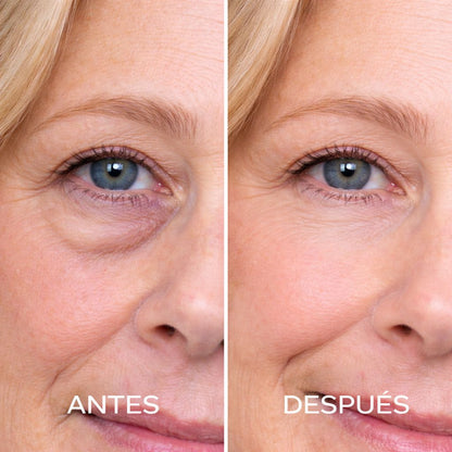 EYE SKIN CONTOUR ROLL-ON