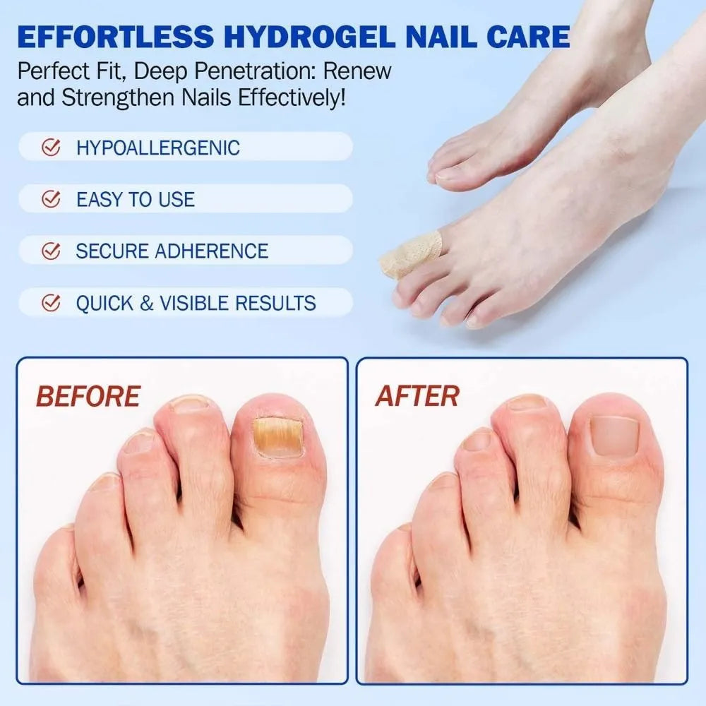 NAILFIX REPAIR PATCHES