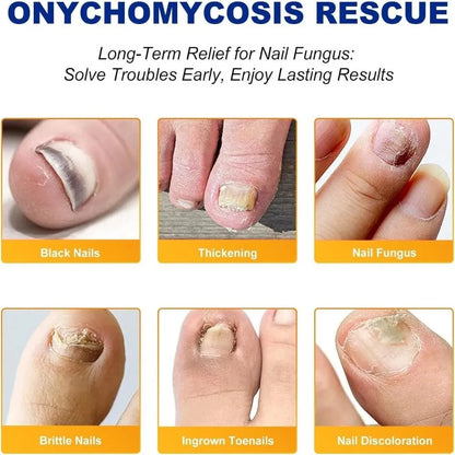 NAILFIX REPAIR PATCHES