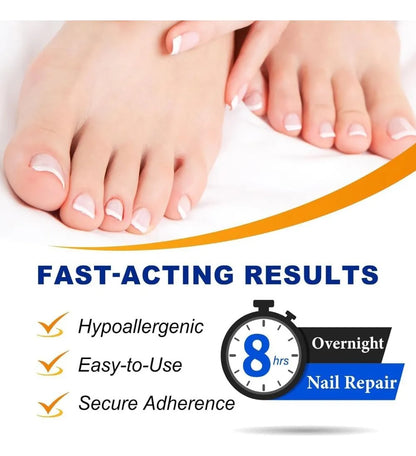 NAILFIX REPAIR PATCHES