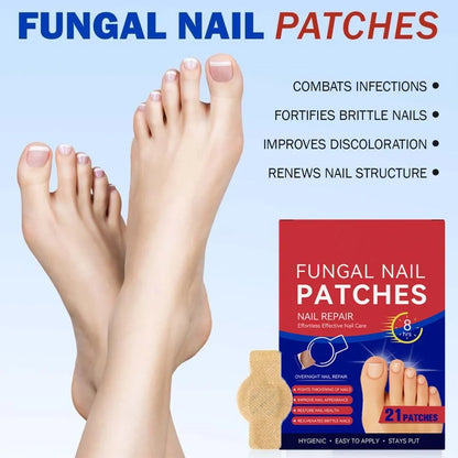 NAILFIX REPAIR PATCHES